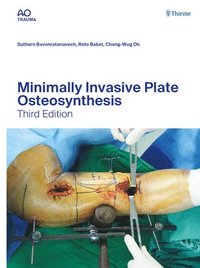 bokomslag Minimally Invasive Plate Osteosynthesis