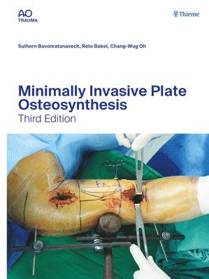 Minimally Invasive Plate Osteosynthesis 1