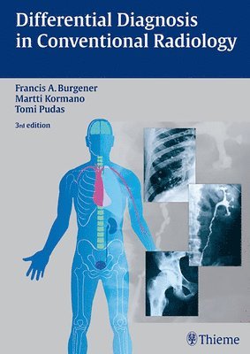 Francis A. Burgener, Martti Kormano, Tomi Pudas - Differential Diagnosis in Conventional Radiology, Inbunden
