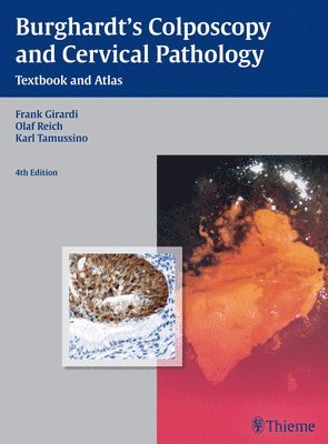 bokomslag Burghardt's Colposcopy and Cervical Pathology