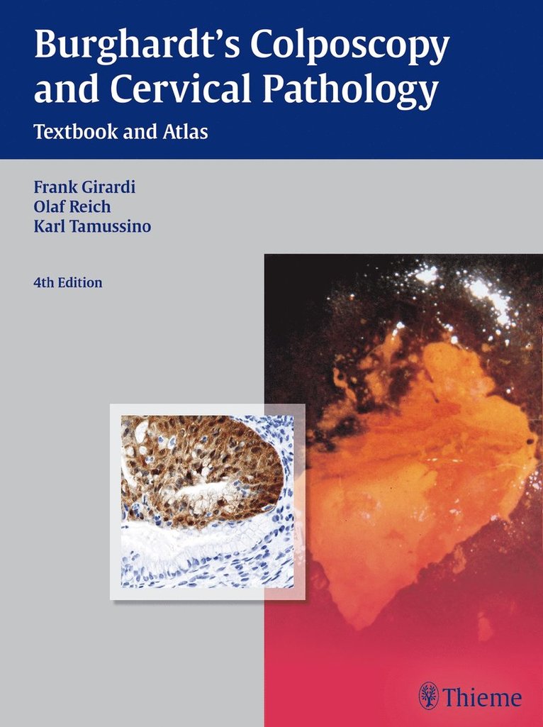 Erich Burghardt, Frank Girardi, Olaf Reich, Karl Tamussino, Hellmuth Pickel - Burghardt's Colposcopy and Cervical Pathology, Inbunden