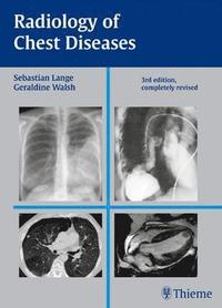 bokomslag Radiology of Chest Diseases