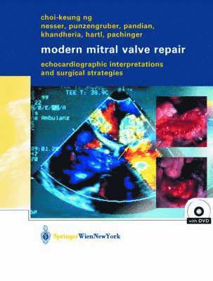 bokomslag Modern Mitral Valve Repair