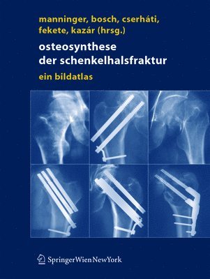 bokomslag Osteosynthese der Schenkelhalsfraktur