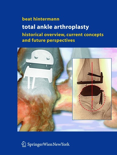 Beat Hintermann - Total Ankle Arthroplasty, Inbunden