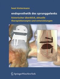 bokomslag Endoprothetik des Sprunggelenks