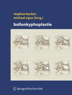 Ballonkyphoplastie 1