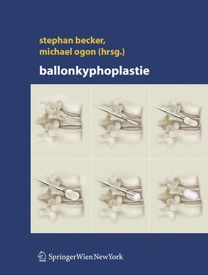 Stephan Becker, Michael Ogon - Ballonkyphoplastie, Inbunden