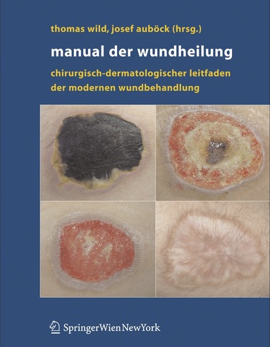 Thomas Wild, Josef Auböck - Manual der Wundheilung, Inbunden