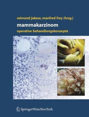 Mammakarzinom 1