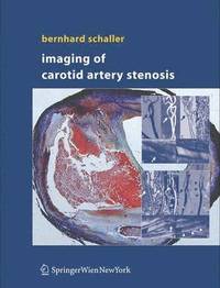 bokomslag Imaging of Carotid Artery Stenosis
