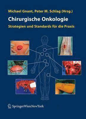 Chirurgische Onkologie 1