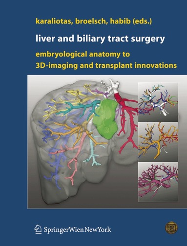 Constantine C. Karaliotas, Christoph E. Broelsch, Nagy A. Habib - Liver and Biliary Tract Surgery, Inbunden
