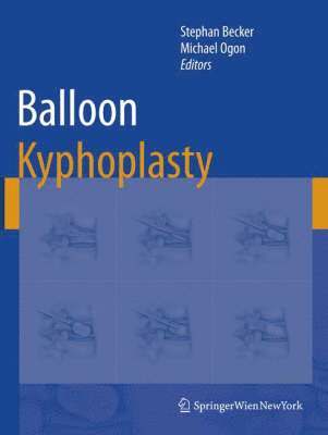 Stephan Becker, Michael Ogon - Balloon Kyphoplasty, Inbunden
