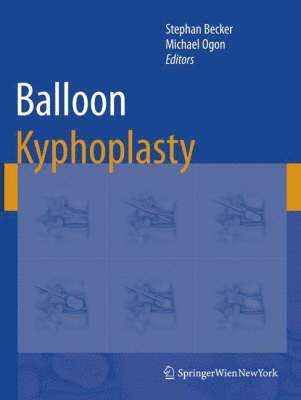 Balloon Kyphoplasty 1