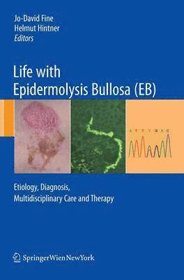 bokomslag Life with Epidermolysis Bullosa (EB)