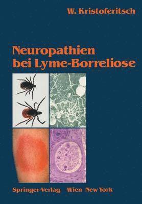 bokomslag Neuropathien bei Lyme-Borreliose