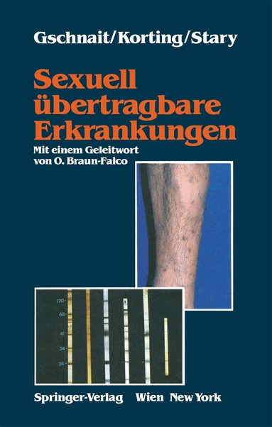 Fritz Gschnait, Hans C. Korting, Angelika Stary - Sexuell übertragbare Erkrankungen, Häftad