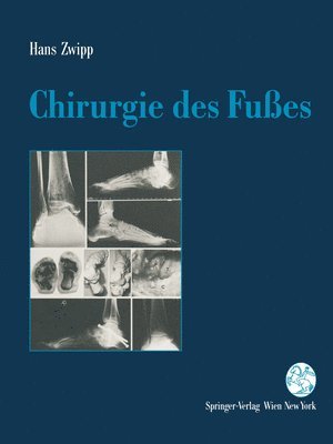 bokomslag Chirurgie Des Fuaes