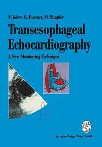 bokomslag Transesophageal Echocardiography