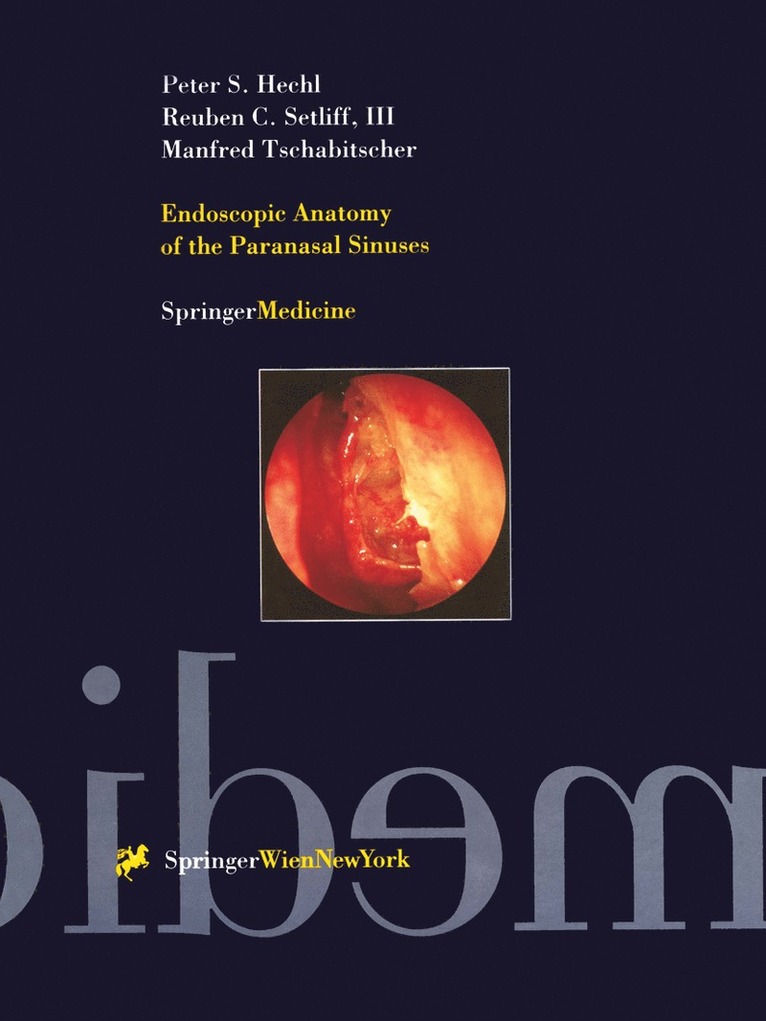 Endoscopic Anatomy of the Paranasal Sinuses 1