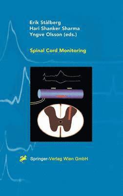 Spinal Cord Monitoring
