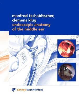 Endoscopic Anatomy of the Middle Ear 1