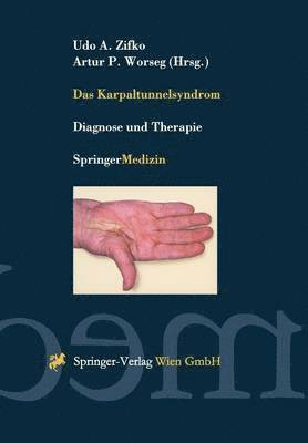 Udo A. Zifko, Artur P. Worseg - Das Karpaltunnelsyndrom, Häftad