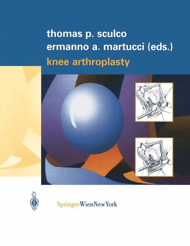 Thomas P. Sculco, Ermanno A. Martucci - Knee Arthroplasty, Inbunden