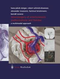 bokomslag Neurosurgery of Arteriovenous Malformations and Fistulas