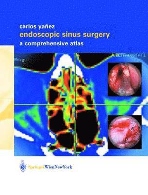 bokomslag Endoscopic Sinus Surgery