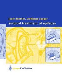 bokomslag Surgical Treatment of Epilepsy