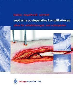 bokomslag Septische postoperative Komplikationen