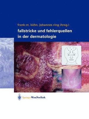 bokomslag Fallstricke und Fehlerquellen in der Dermatologie