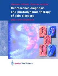 bokomslag Fluorescence Diagnosis and Photodynamic Therapy of Skin Diseases