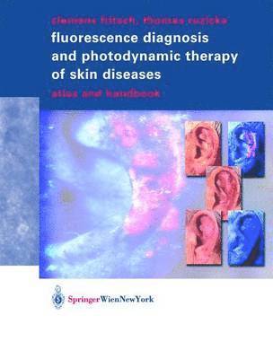 bokomslag Fluorescence Diagnosis and Photodynamic Therapy of Skin Diseases