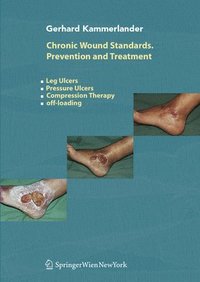 bokomslag Chronic Wound Standards - Prevention and Treatment