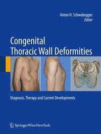 bokomslag Congenital Thoracic Wall Deformities