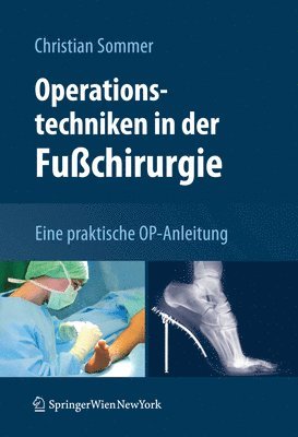 Christian Sommer - Operationstechniken in der Fußchirurgie, Inbunden