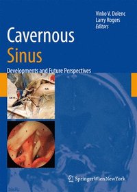 bokomslag Cavernous Sinus