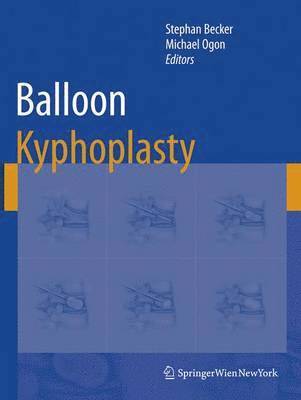 Balloon Kyphoplasty 1