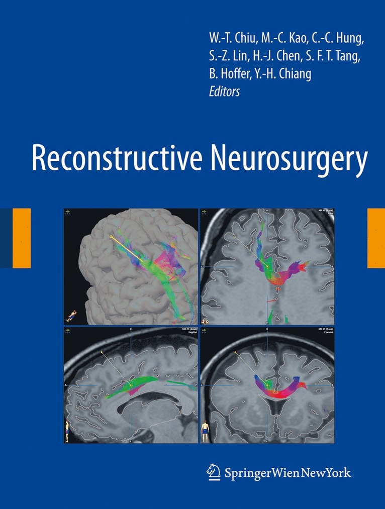 Wen-Ta Chiu, Ming-Chien Kao, Ching-Chang Hung, Shinn-Zong Lin, Han-Jung Chen, Simon F. T. Tang, Barry J. Hoffer, Yung-Hsiao Chiang - Reconstructive Neurosurgery, Häftad