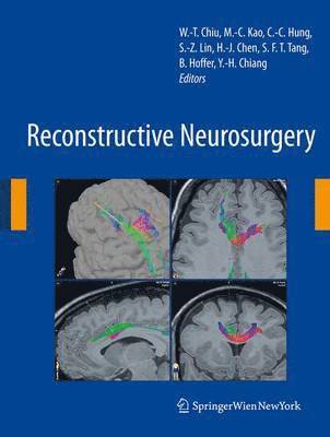 Reconstructive Neurosurgery 1
