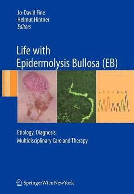 bokomslag Life with Epidermolysis Bullosa (EB)