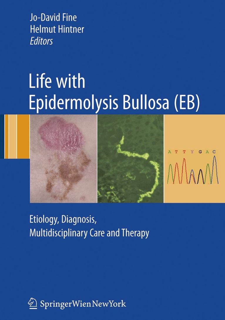Jo-David Fine, Helmut Hintner - Life with Epidermolysis Bullosa (EB), Häftad