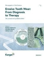 bokomslag Erosive Tooth Wear: From Diagnosis to Therapy