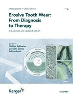 Nadine Schlueter, Carolina Ganss, Adrian Lussi - Erosive Tooth Wear: From Diagnosis to Therapy, Inbunden