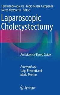 bokomslag Laparoscopic Cholecystectomy