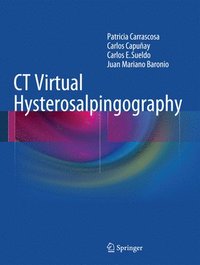 bokomslag CT Virtual Hysterosalpingography