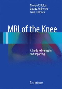 bokomslag MRI of the Knee